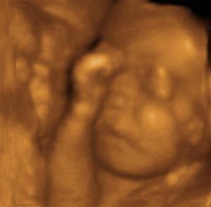 feto a 28 settimane di gravidanza