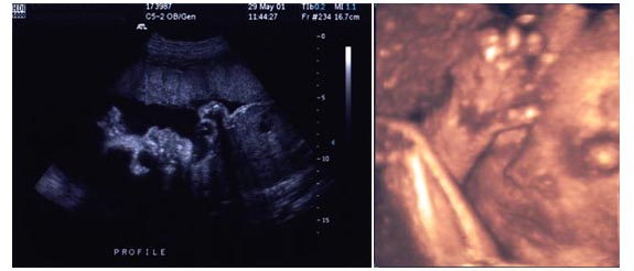 feto a 30 settimane di gravidanza