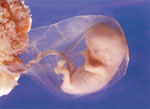 feto a 8 settimane